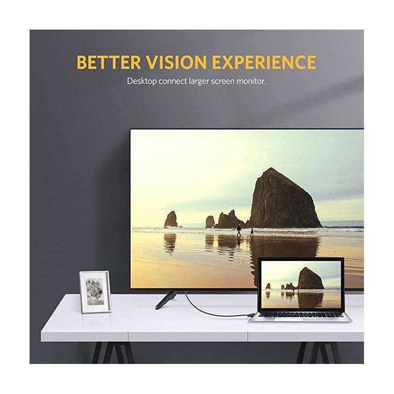 UGREEN DVI (24+1) Male to Male Gold Plated Cable - Black